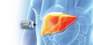 Δωρεάν Πρόγραμμα Ελαστογραφίας Ήπατος για την Τρίτη Ηλικία στη Βέροια