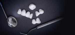 Αναδείξτε το χαμόγελό σας με θήκες δοντιών υψηλής ποιότητας!