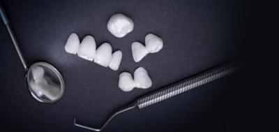 Αναδείξτε το χαμόγελό σας με θήκες δοντιών υψηλής ποιότητας!