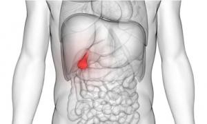 Ελάχιστα επεμβατική χειρουργική μέθοδος για οριστική λύση της χολολιθίασης