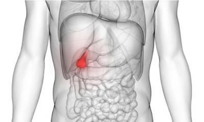 Ελάχιστα επεμβατική χειρουργική μέθοδος για οριστική λύση της χολολιθίασης