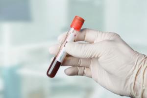 Καρδιακοί δείκτες – Τι είναι και γιατί μετρώνται