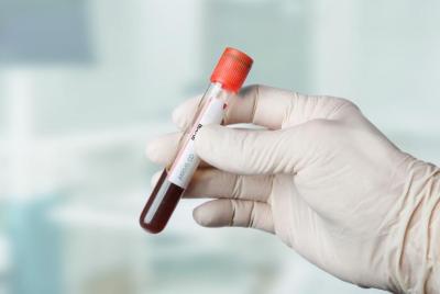 Καρδιακοί δείκτες – Τι είναι και γιατί μετρώνται