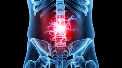 Απαλλαγείτε από τη δισκοκήλη και αποκτήστε ξανά υγιή σπονδυλική στήλη!